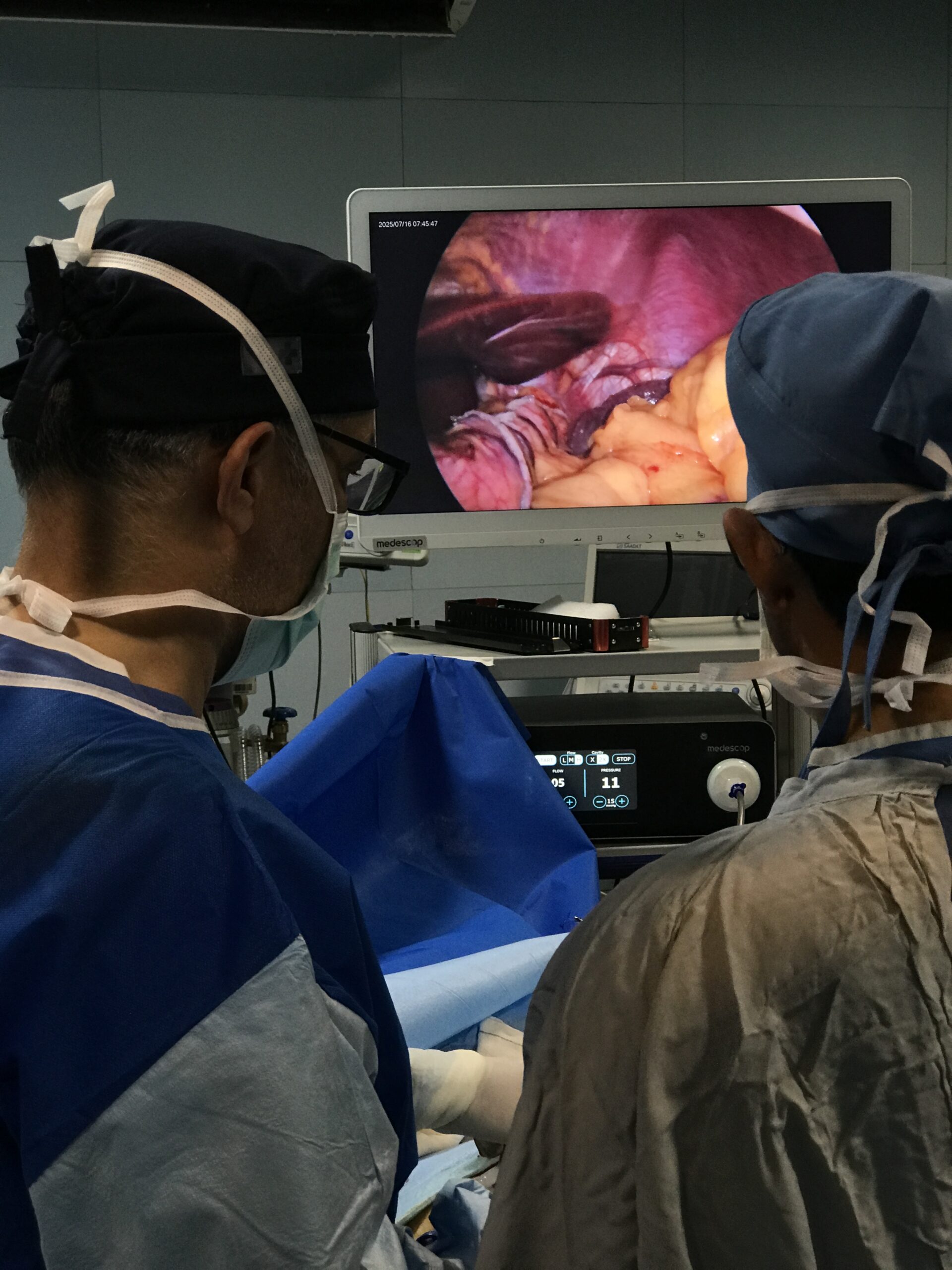 تاریخچه جراحی لاپاروسکوپی